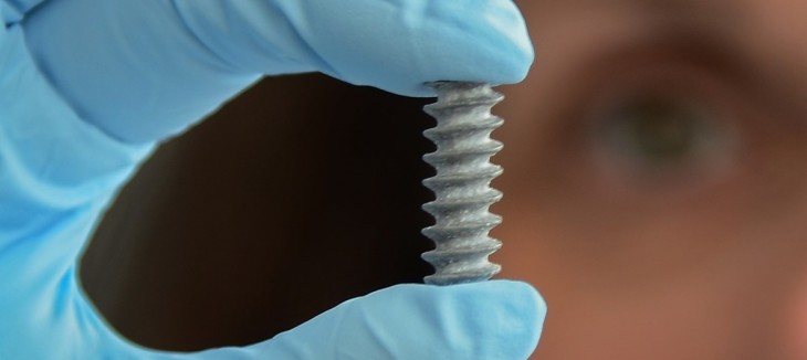 Biologisch abbaubare Magnesium-Implantate