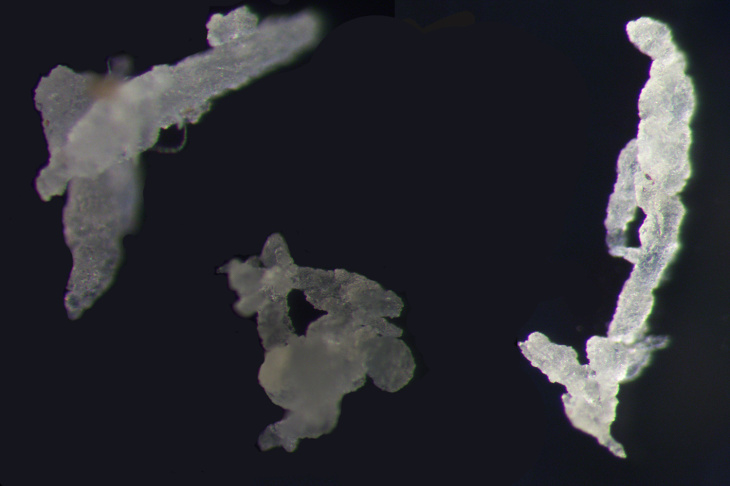 Mikroplastik-partikel (von Ethylen-Propylen-Dien-Kautschuk-Partikeln (EPDM)) unter dem Mikroskop